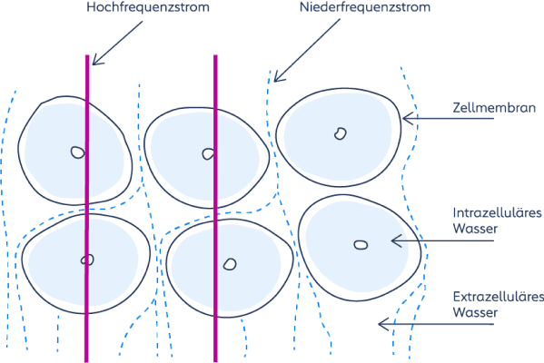 Niedrige Messfrequenzen erfassen nur extrazelluläres Wasser (ECF), hohe Frequenzen durchdringen die Zellmembran und erfassen auch intrazelluläres Wasser (ICF). So lässt sich der Flüssigkeitsstatus segmental und differenziert bestimmen.